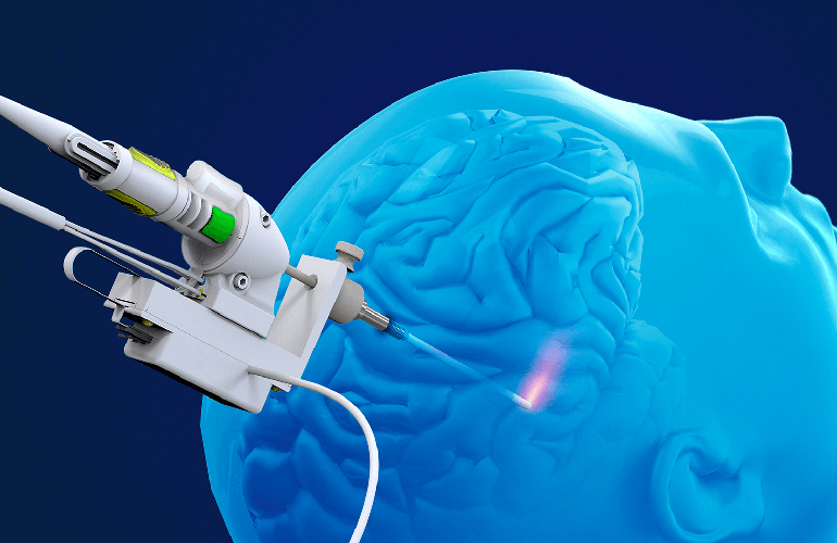Monteris Medical 与 Symphony Robotics 合作，利用人工智能驱动的微型机器人推进 MRI 引导脑部手术