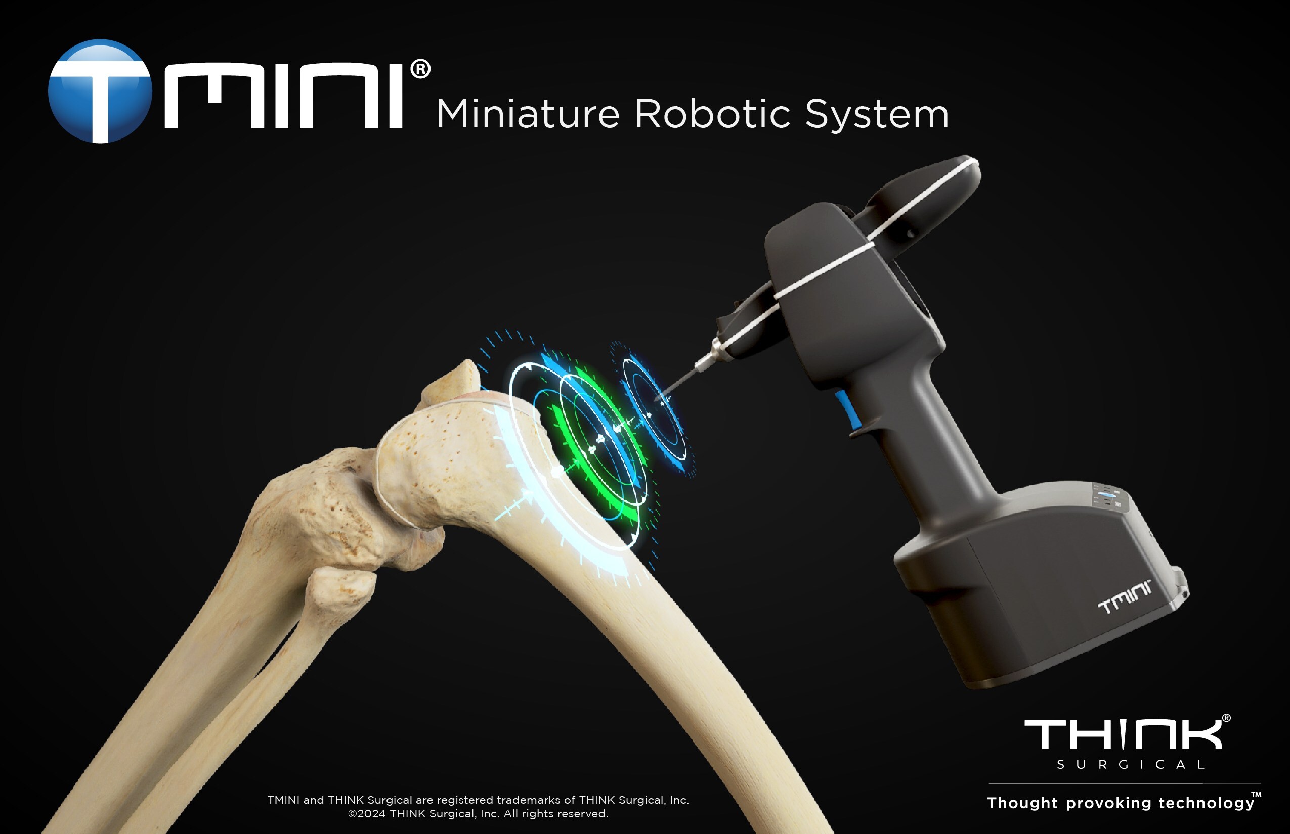 THINK Surgical 的 TMINI® 机器人系统已完成 5,000 例膝关节手术，这是里程碑