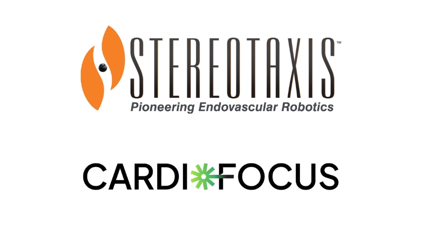 Stereotaxis 和 CardioFocus 宣布合作推进机器人脉冲场消融技术走向商业化