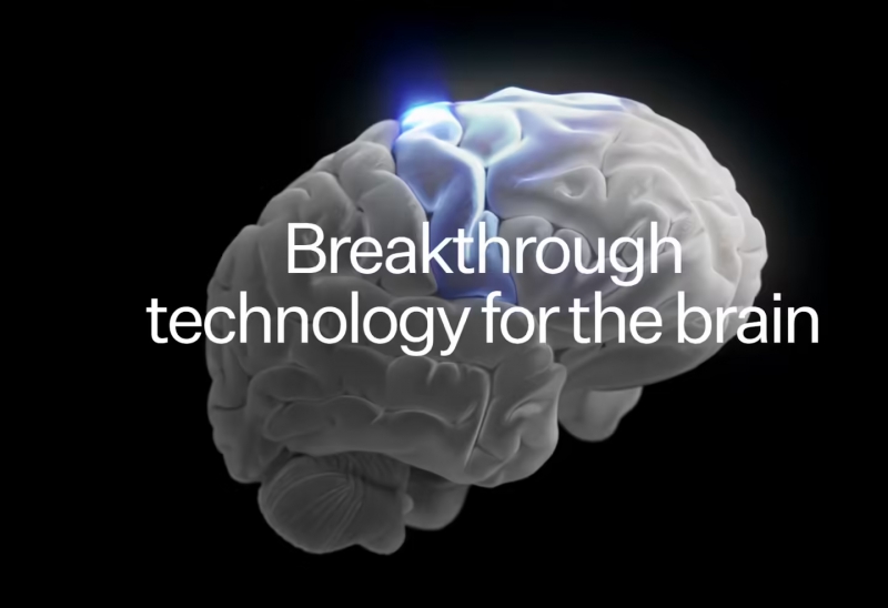 马斯克被曝将旗下脑机接口公司 Neuralink 登记为“小微企业”以优先获得政府合同(图1) 马斯克被曝将旗下脑机接口公司 Neuralink 登记为“小微企业”以优先获得政府合同(图1)